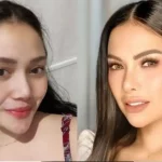 Biaya Operasi Hidung